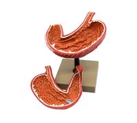 Modello Stomaco Scomponibile - Modello Didattico Anatomico a Grandezza Naturale
