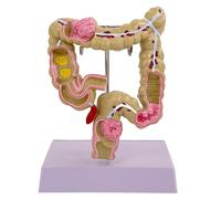 Modello umano dell'intestino crasso per l'anatomia di aiuto didattico forniture scolastiche patologie di patologie di strumento didattico