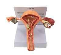 Modello utero - Modello anatomico del sistema riproduttivo femminile per l'educazione fisiologica, modello anatomicamente accurato di anatomia ovarica per l'apprendimento degli organi interni