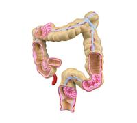 Modello visualizzazione anatomia per lezioni patologia digestiva, sussidio didattico in PVC con dettagli colore in classe Modello anatomia patologia digestiva sussidio didattico