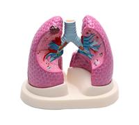 Modelo anatómico comparativo de pulmón normal y patológico para clases | Modelo pulmonar desmontable sistema respiratorio humano con base PVC para estudio anatomía y fisiología enfermería
