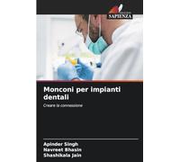 Monconi per impianti dentali: Creare la connessione