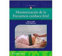 Monitorización de la frecuencia cardiaca fetal