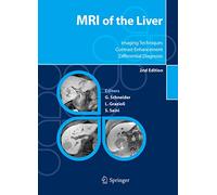 MRI of the Liver. Imaging techniques, contrast enhancement, differential diagnosis