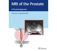 MRI of the Prostate: A Practical Approach