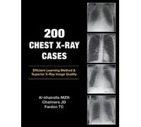 Mudher Al-khairalla James Chalmers Tom Fardon 200 Chest X-Ray Cases (Tascabile)