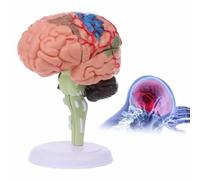 Mumusuki Cervello Umano, Omes con Una Base Bianca, 1 Pz Modello Anatomico del Cervello Umano Smontato Modello Anatomico, Materiale Plastico Resistente per La Scuola A Casa