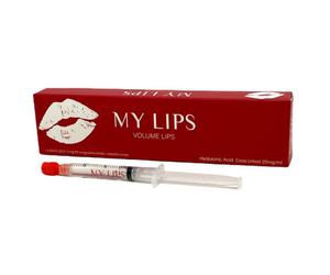 My Lips - Filler Volume Lips 25Mg/Ml Siringa Preriempita Confezione 1 x 3 ML