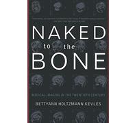 Naked to the Bone: Medical Imaging In The Twentieth Century