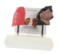 NAMOARLY Modello Anatomico Polmonare Didattico Vivid con Confronto Polmone per Scuole Mediche e Infermieristiche Materiale Durevole e Sicuro per Apprendimento e Comunicazione