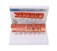 Naroote Modello di Anatomia Dell'arteria Modello Realistico Dell'arteria del Corpo Umano per Strumento Educativo per Studenti di Medicina, di Anatomia 7 Pezzi per Studio Medico, Materiale in PVC