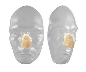 NASO DA BOXER IN LATTICE