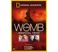 National Geographic: In the Womb - Identical Twins