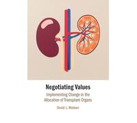 Negotiating Values: Implementing Change in the Allocation of Transplant Organs