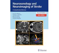 Neurosonology and Neuroimaging of Stroke: A Comprehensive Reference