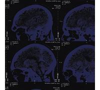Nightingales - Mind Over Matter