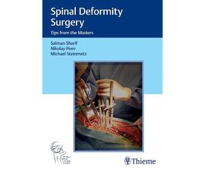 Nikolay Peev Spinal Deformity Surgery (Copertina rigida)