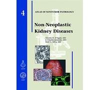 Non-neoplastic Kidney Diseases: No 4