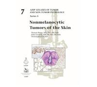 Nonmelanocytic Tumors of the Skin: 7