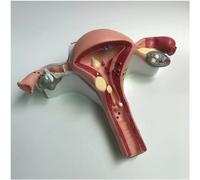 NZPOST Modello anatomico del Corpo Umano, Modello di Utero Femminile, Modelli didattici, Modello anatomico dell'utero patologico, Anatomia degli organi Umani