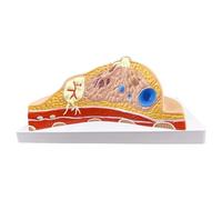 NZPOST Modello anatomico delle lesioni mammarie Modello anatomico del Torace Femminile Modello di Organo Umano per sussidi didattici (A)