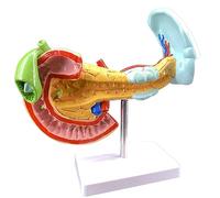 NZPOST Modello anatomico di Organo Umano, Pancreas, milza, fegato e cistifellea lesionati, Modello per l'insegnamento della patologia digestiva