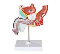 NZPOST Modello di Anatomia Maschile, Modello di organi del Corpo Umano, Modello di calcoli uretrali e verruche per Dispositivo didattico