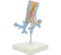 NZPOST Modello di Organo Umano in PVC, Modello di Anatomia patologica dell'albero bronchiale, Modello respiratorio Umano per l'apprendimento
