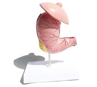 NZPOST Modello di Organo Umano Modello di Stomaco patologico Attrezzatura didattica di Anatomia Medica per organi digestivi (A)