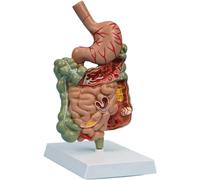 NZPOST Modello digestivo patologico, Modello di Organo dell'intestino Tenue, Modello di Anatomia dello Stomaco Umano per l'insegnamento agli Studenti