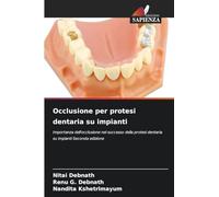Occlusione per protesi dentaria su impianti: Importanza dell'occlusione nel successo della protesi dentaria su impianti Seconda edizione
