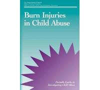 Office of Justice Programs Office of Juvenile Justic Burn Injuries i (Tascabile)