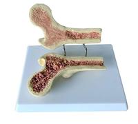 OLDMFZP Modello di osteoporosi femorale Umana, Scheletro anatomico delle Vertebre con Scheda di Studio for dimostrazione Medica, insegnamento in Classe di scienze, dimostrazione for Studenti