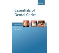 Ole Fejerskov Edwina Kidd Essentials of Dental Caries (Tascabile)