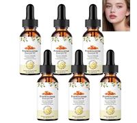 Olio essenziale di estratto di resina, crema idratante viso e corpo, idratante per idratante e nutriente, anti-invecchiamento, cura dei capelli, oli essenziali aromaterapia (6 pezzi)