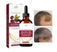 Olio per la crescita dei capelli - Olio anticrespo all'olio di jojoba per capelli spessi | Olio naturale per la crescita dei capelli per uomini e donne, Olio per la crescita dei capelli selvaggi