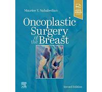 Oncoplastic Surgery of the Breast