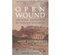 Open Wound: The Tragic Obsession of Dr. William Beaumont