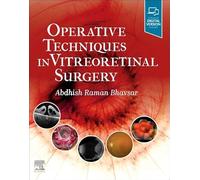 Operative Techniques in Vitreoretinal Surgery