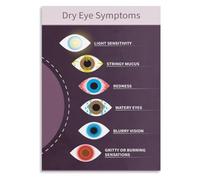 Ophthalmology Dry Eye Poster Patient Education Visual Guide