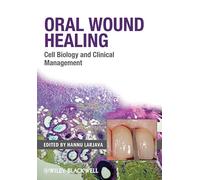 Oral Wound Healing: Cell Biology and Clinical Management