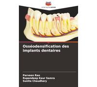 Osséodensification des implants dentaires
