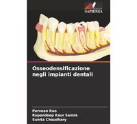 Osseodensificazione negli impianti dentali