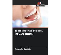 OSSEOINTEGRAZIONE NEGLI IMPIANTI DENTALI