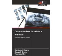 Osso alveolare in salute e malattia: Transizione dell'osso alveolare