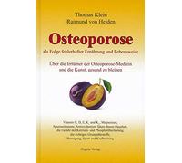 Osteoporose: als Folge fehlerhafter Ernährung und Lebensweise. Über die Irrtümer der Osteoporose-Medizin und die Kunst, gesund zu bleiben