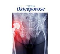 Osteoporose kompakt für Pflegekräfte - das kleine Kittelbuch: Alles, was Auszubildende wissen müssen - einfach, verständlich, prüfungsrelevant