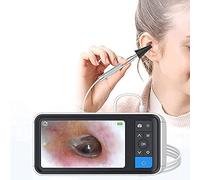 Otoscopio digitale, obiettivo da 3,9 mm, schermo da 4,5 pollici, otoscopio digitale con 6 luci a LED, fotocamera con cera per orecchie con batteria ricaricabile da 2500 mAh, per adulti, bambini e