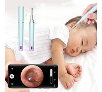Otoscopio per rimozione del cerume, con luce, 1080P HD, fotocamera digitale Otoscopo, 3,9 mm, ultra sottile, IP67, impermeabile, endoscopio e WiFi, per iPhone, iPad e Android (blu)
