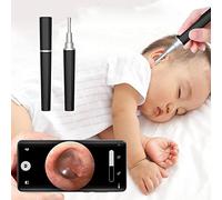 Otoscopio per rimozione del cerume, con luce, 1080P HD, fotocamera digitale Otoscopo, 3,9 mm, ultra sottile, IP67, impermeabile, endoscopio e WiFi, per iPhone, iPad e Android (nero)